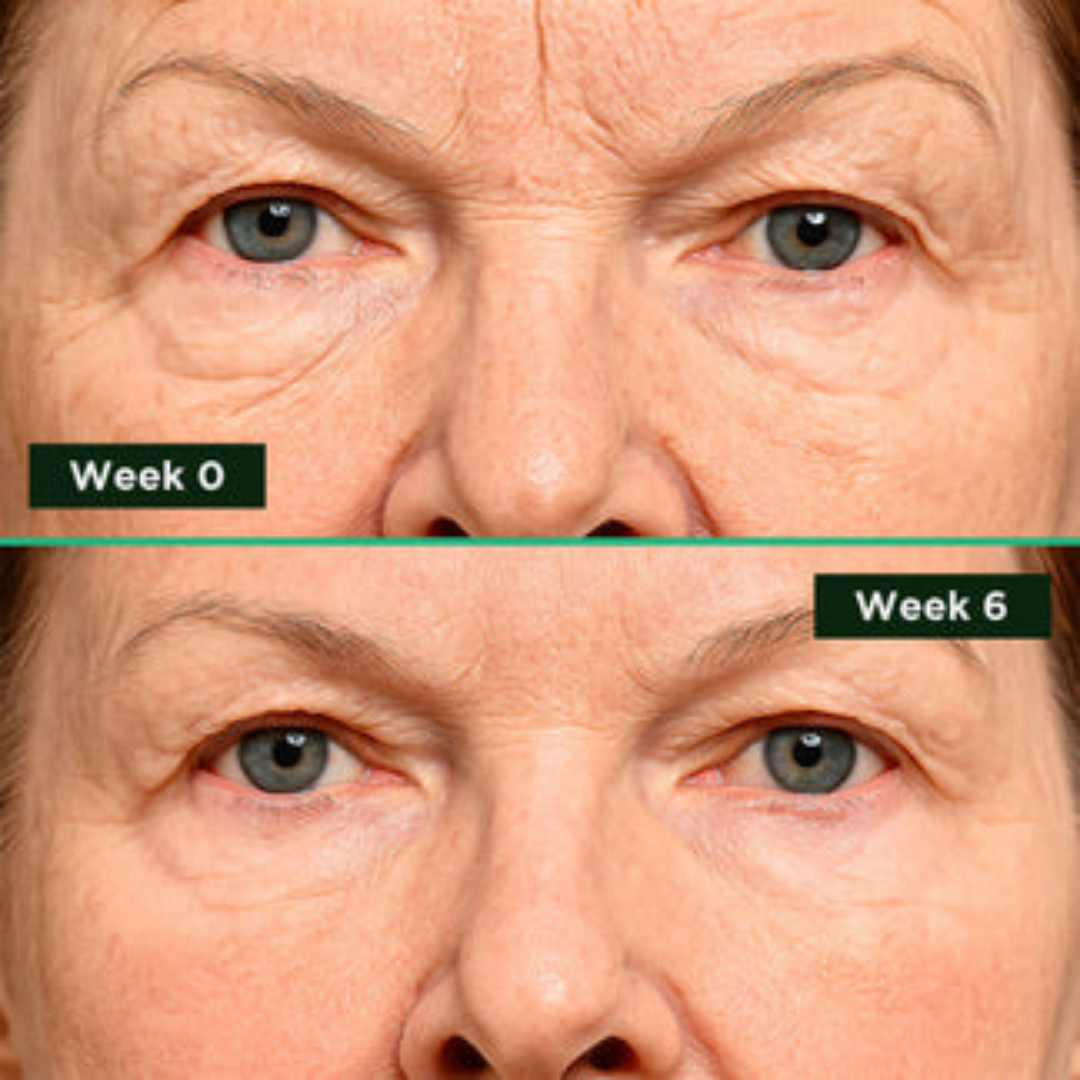 ESILACARE® Beauty Collagen Bant